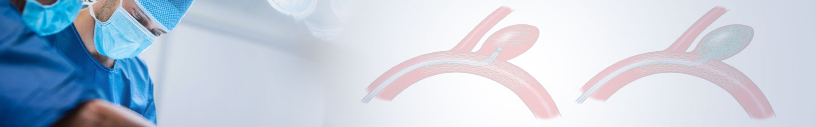 Endovascular Neurosurgery